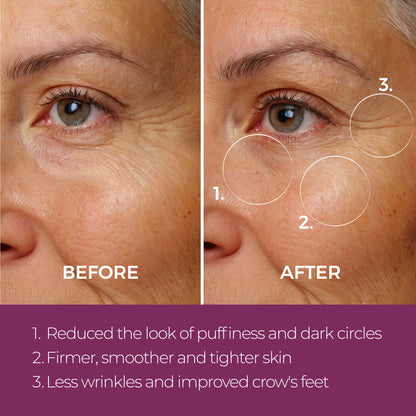 Eye Repair Peptide Complex