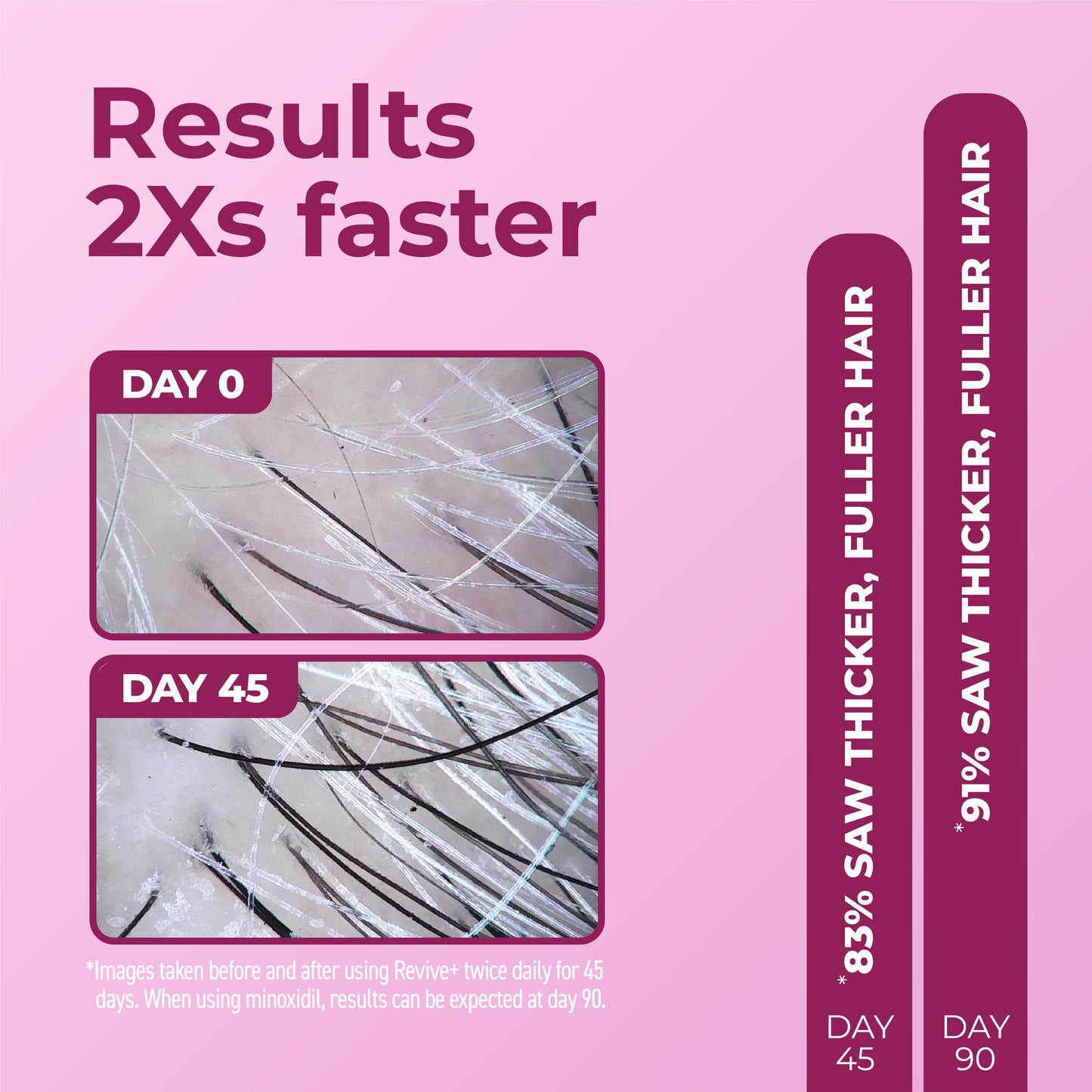 Results 2 times faster. Images of day 0 and day 45.