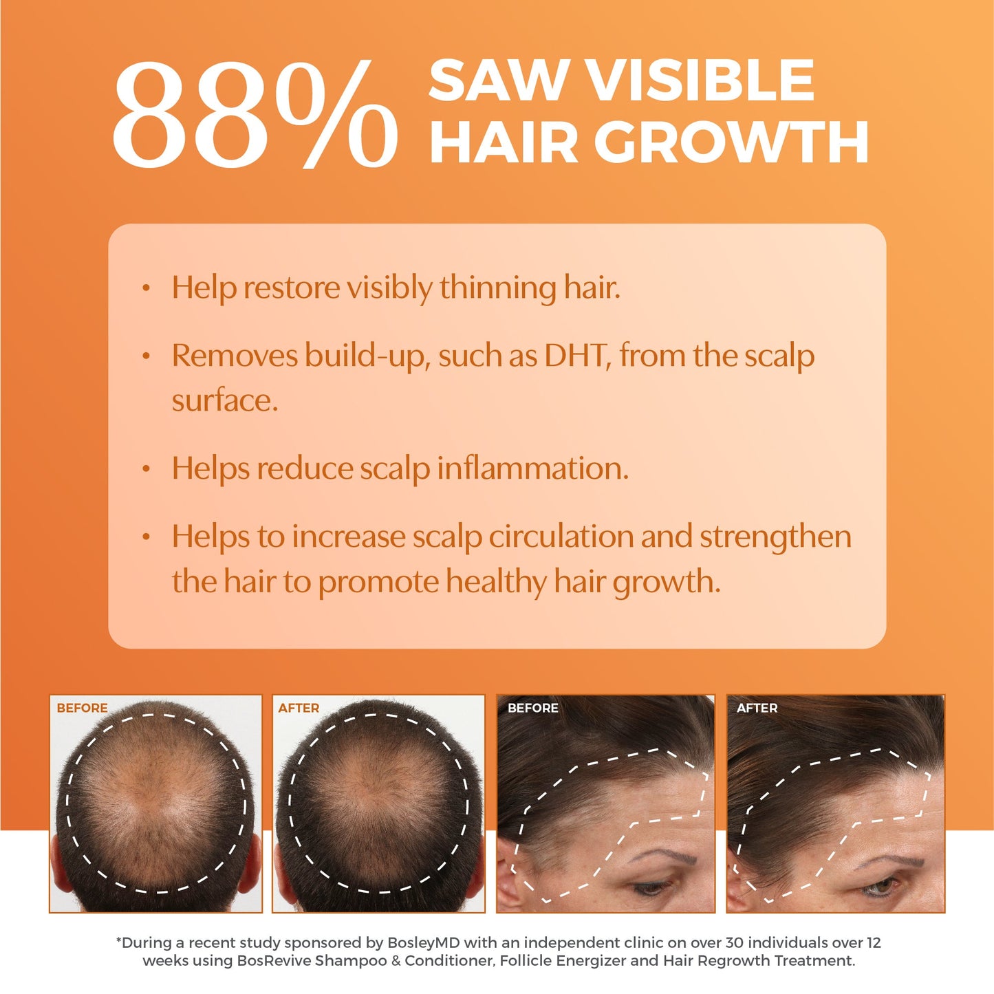 88% Saw visible hair growth with before and after images.