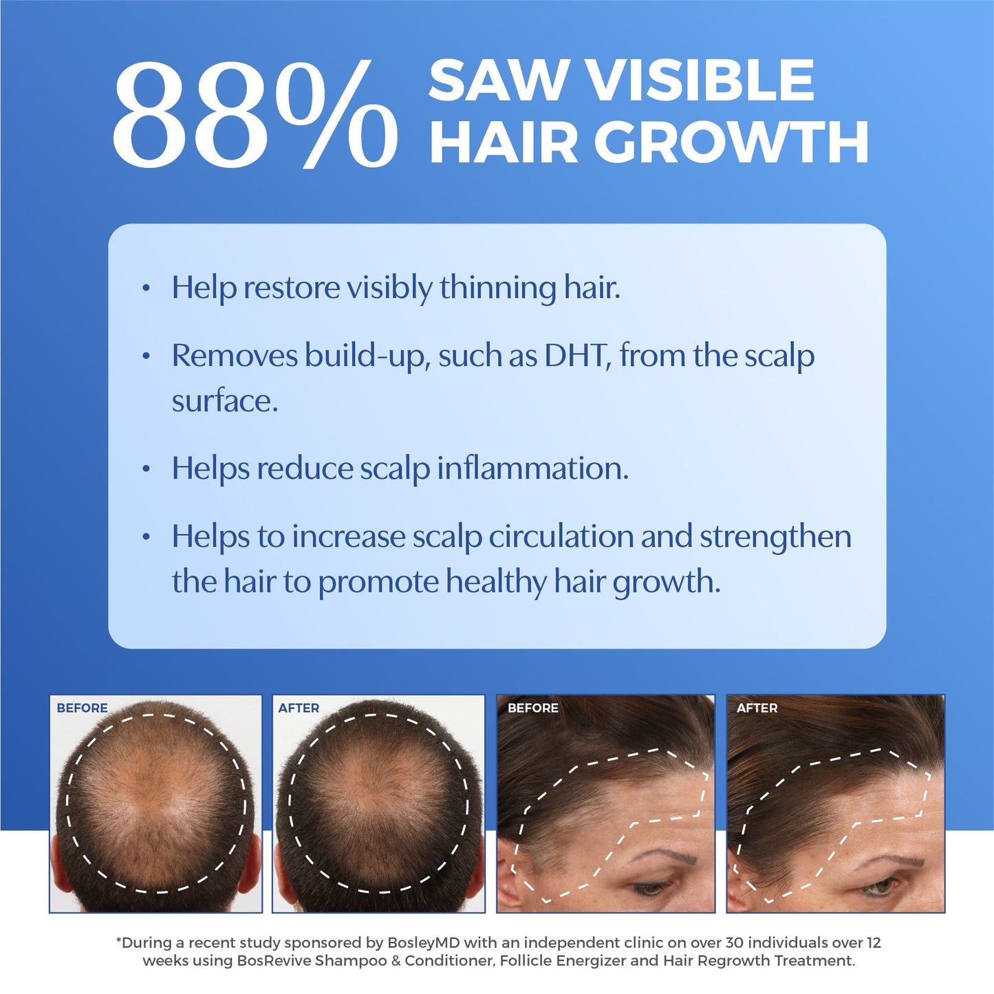 88% saw visible hair growth with before and after images.
