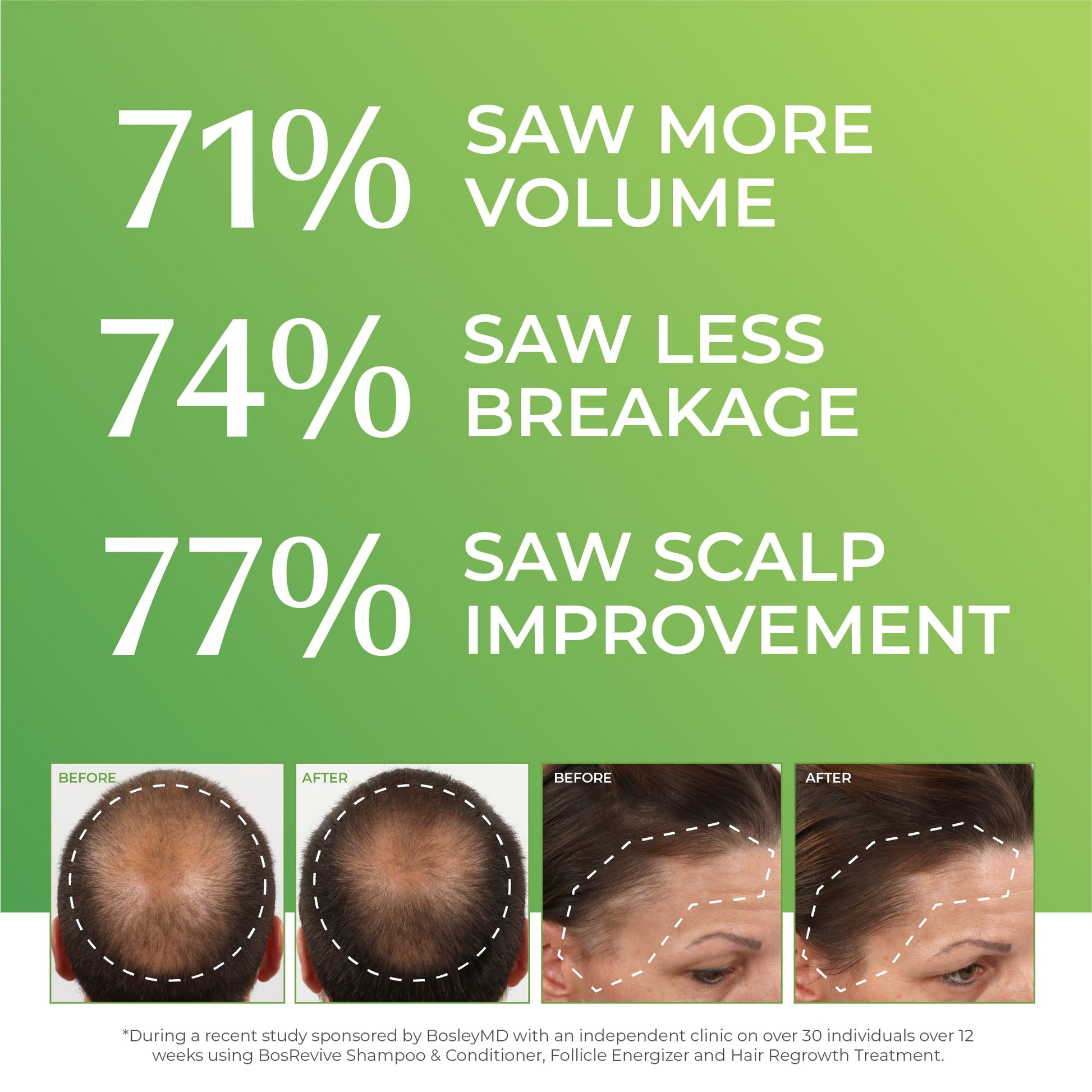 71% saw more volume. 74% saw less breakage. 77% saw scalp improvement. Male and female before and after images.