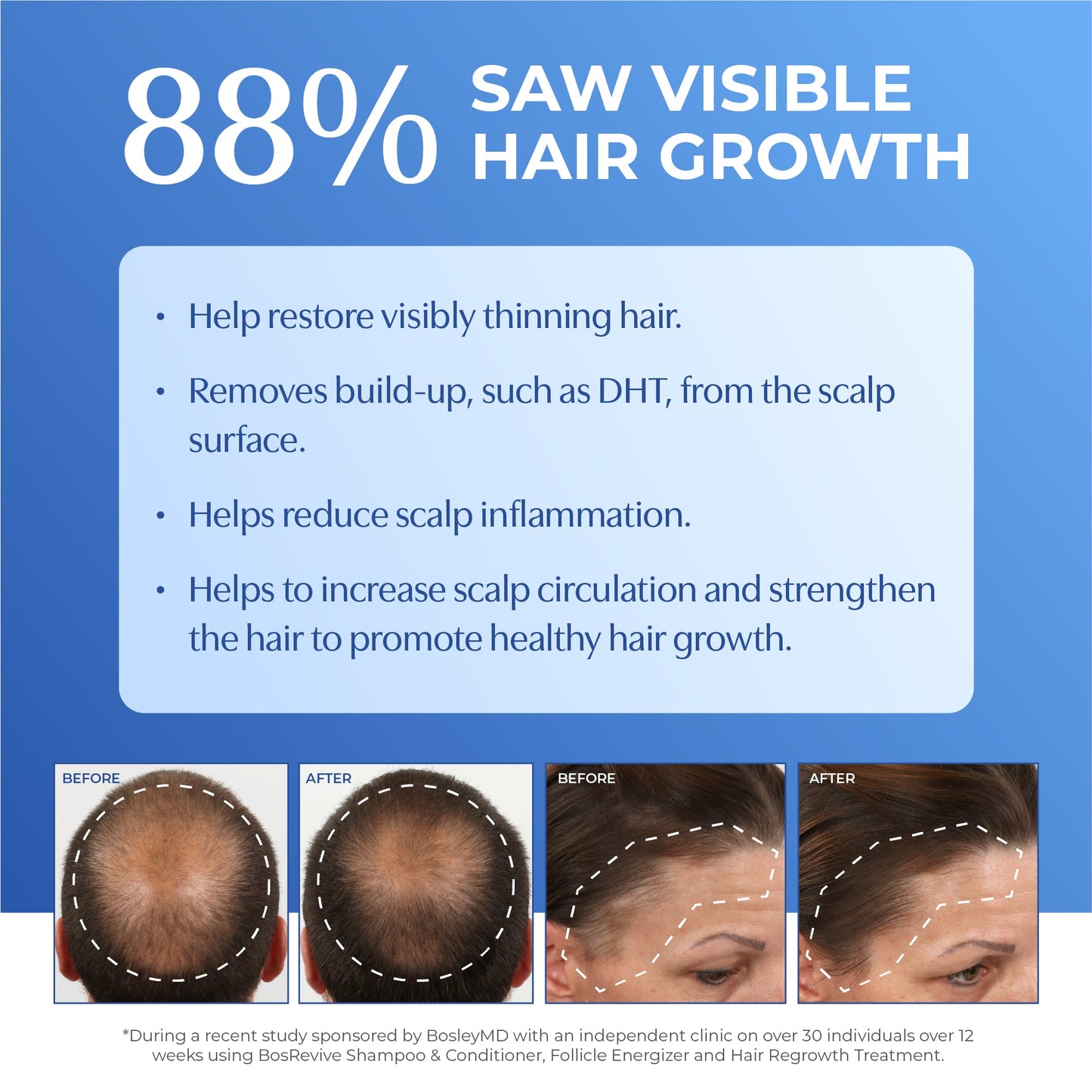 88% saw visible hair growth with before and after images.