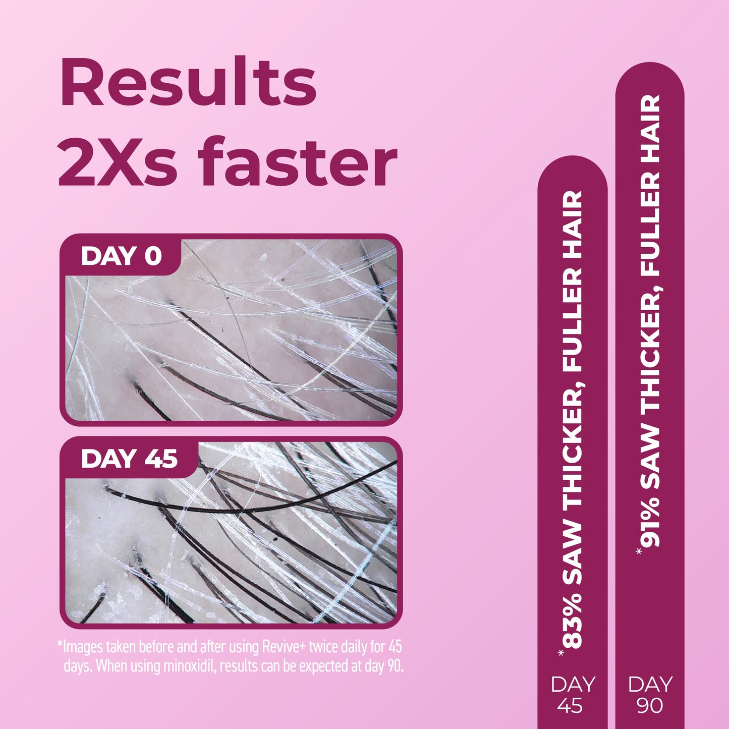 Results 2 Times Faster with Day 0 and Day 45 images.